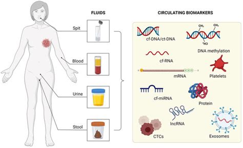 Ijms Free Full Text Liquid Biopsy As A Tool For The Diagnosis