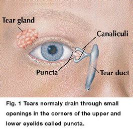 Blocked Tear Duct - Kids Eye Care of Maryland