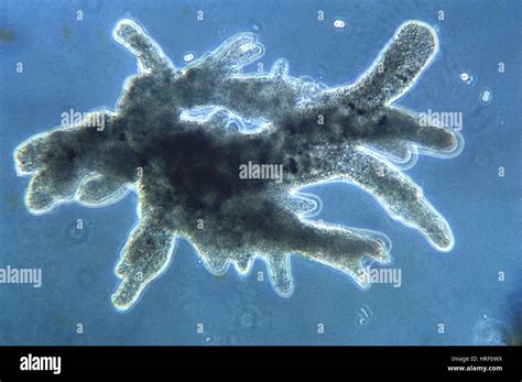 Protozoa, Amoeba, LM Stock Photo - Alamy