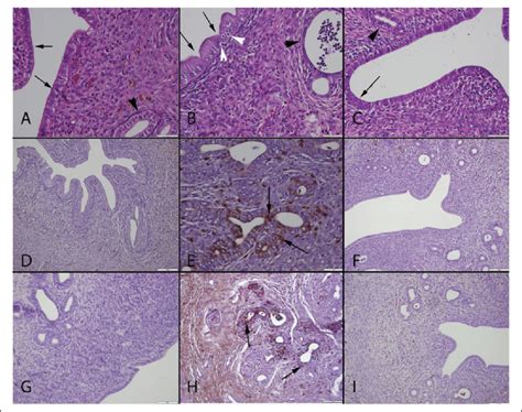 Microscopic Appearance Of The Uterus In The Groups A Normal