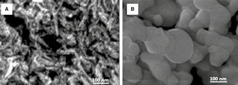 Synthesis And Characterization Of Pure And Nanosized Hydroxyapatite