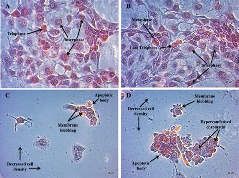 Haematoxylin And Eosin Staining Images Revealing Morphological Changes