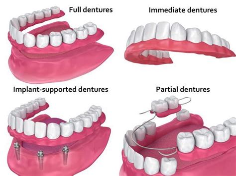 Affordable Dentures In Phoenix Full And Partial Dentures Near Me 1