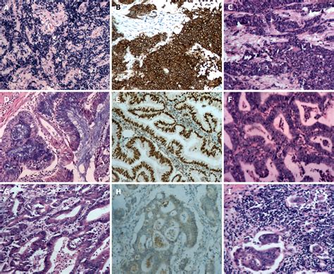 Histology Slides Database Uterus In Secretary Phase High