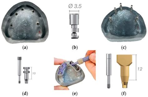 JPM Free Full Text Accuracy Of Conventional And Digital Impressions