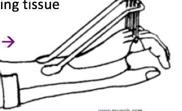 Mobilization Splinting Flashcards Quizlet