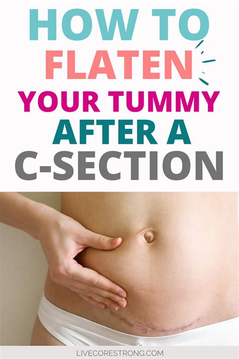 You Just Had A Baby Via Cesarean Section And You Are Wondering How To