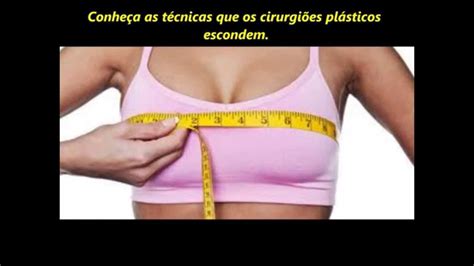 Como Aumentar Os Seios Em Até 300 Ml Sem Cirurgia Youtube