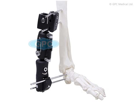 Ankle Joint External Fixator in PEEK Manufacturer, Supplier & Exporter ...