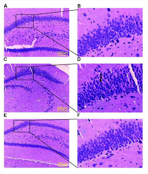 Dentate Gyrus Histology