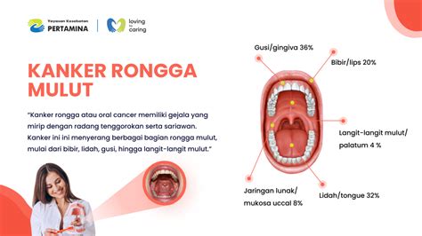 Kanker Rongga Mulut Yakes Pertamina