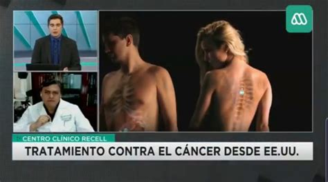 La Inmunoterapia Tratamiento Eficaz Contra El Cáncer Latam Recell