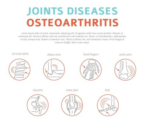 Enfermedades Articulares Artritis S Ntomas De Osteoartritis Conjunto