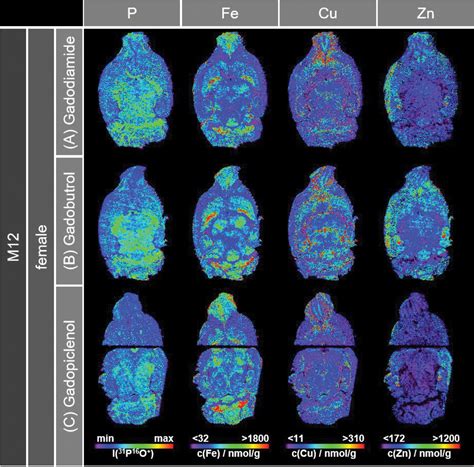 Long Term Gadolinium Retention In The Healthy Rat Brain Comparison