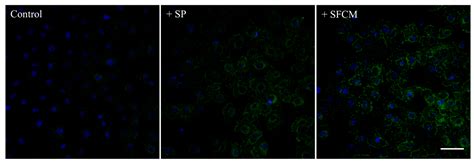 Ijms Free Full Text Role Of Corneal Stromal Cells On Epithelial