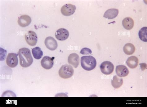 Babesia Microti And Plasmodium Berghei Revealed In Red Blood Cells