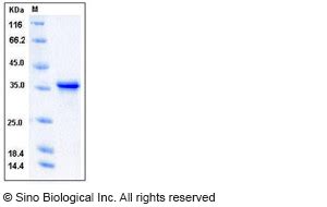 Human CD276 B7 H3 Protein His Tag Biotinylated Scientist