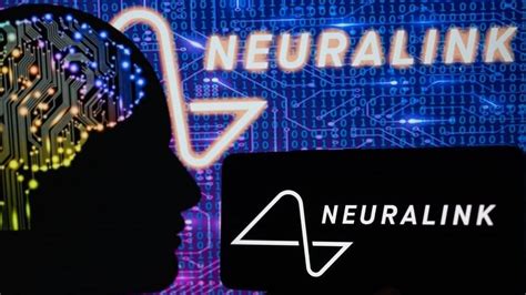 Neuralink De Elon Musk Busca Voluntarios Para Un Estudio Sobre