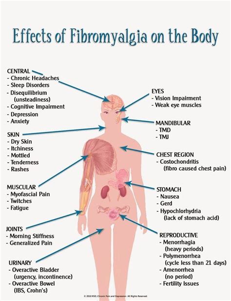 Pin On Fibromyalgia