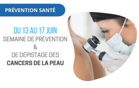 Semaine De Pr Vention Et De D Pistage Des Cancers De La Peau