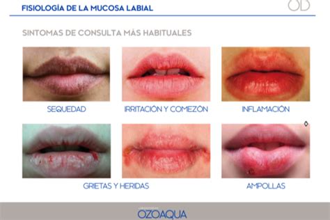 Los Labios Se Secan Mas Rápido Que La Piel Del Rostro Im Farmacias