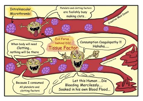 Disseminated Intravascular Coagulation Clotting Cascade