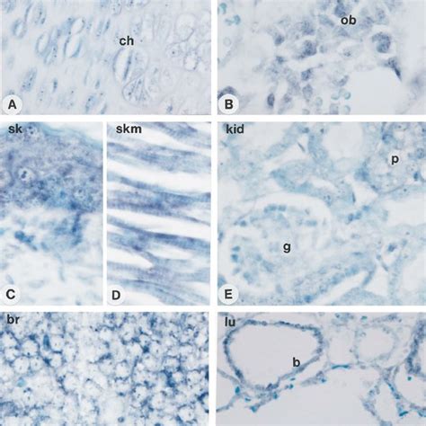 Effect Of Recombinant Mocil And Hocil On Murine Osteoclast Formation