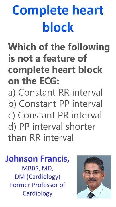 Complete Heart Block Youtube