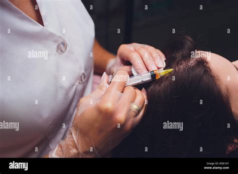 Platelet Rich Plasma Injection Procedure Hair Growth Stimulation Prp