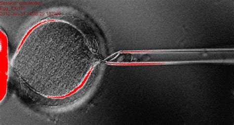 Cloning Produces Human Embryonic Stem Cells