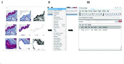 Quantification Of Total Collagen Fibres Distributed In Human Colon Download Scientific Diagram