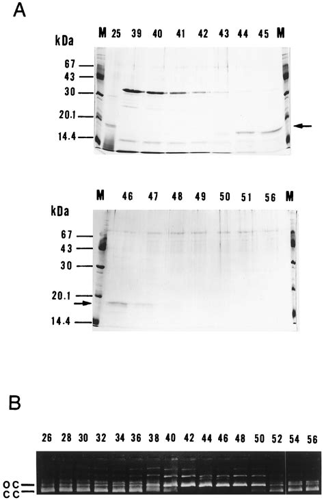 Uv Endonuclease Of Micrococcus Luteus A Cyclobutane Pyrimidine Dimer