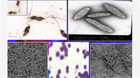 3 1 SPIRAL AND CURVED BACTERIA Campylobacter Flashcards Quizlet