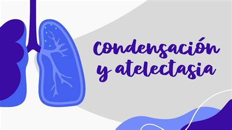 Condensación y atelectasia Marina Armenta uDocz