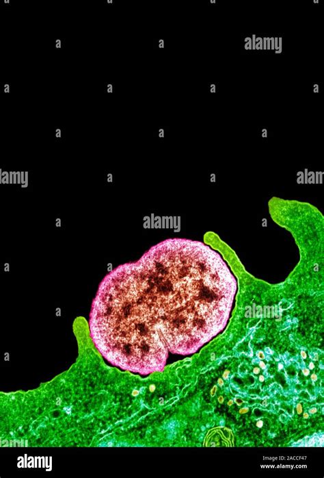 Gonorrhoea Bacteria Coloured Transmission Electron Micrograph Tem Of