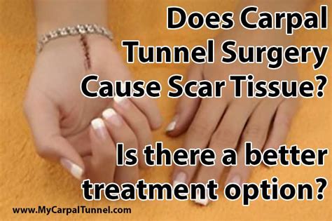 Carpal Tunnel Surgery Scar