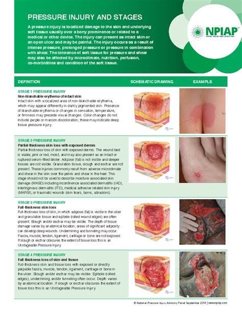 Npiap Staging Definition Schematic Drawing Example Stage 1 Pressure Injury Non Blanchable