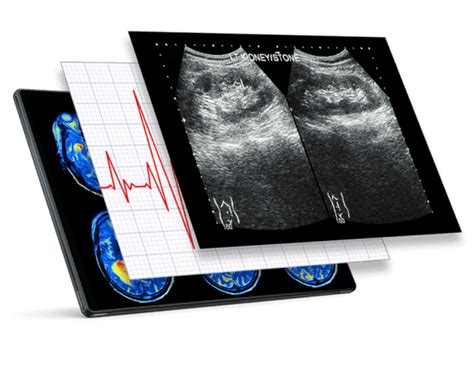 ICPC centres de cardiologie à Paris et Bagnolet RDV