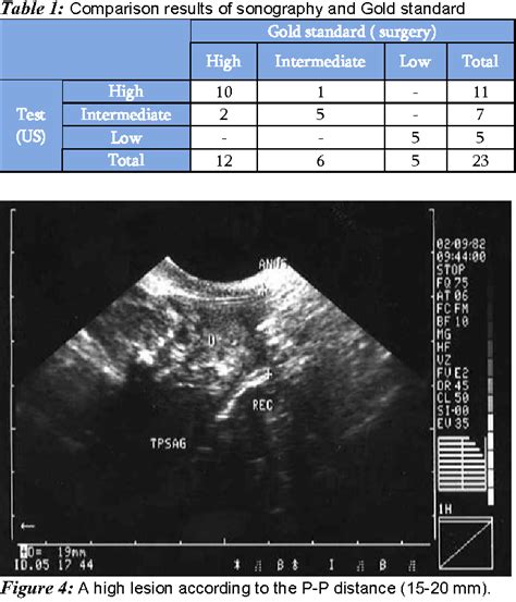 Figure From Validity Of Transperineal Ultrasound In Infants With