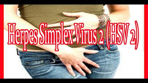 Herpes Simplex Virus 2 : Genital Herpes : Herpes Treatment