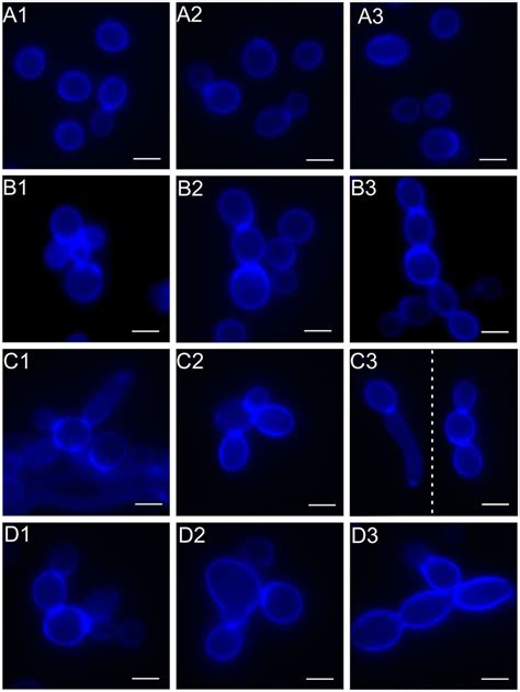 Morphological Changes In C Albicans Cells Treated With The Crude S