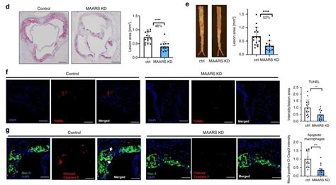 Nature子刊丨巨噬细胞特异性lncrna与hur相互作用调控细胞凋亡和动脉粥样硬化医药新闻 Bydrug 一站式医药资源共享中心 医药魔方