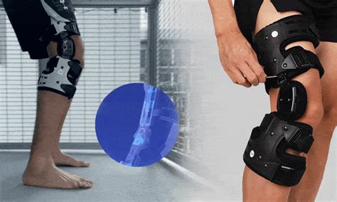 Recoverypro Rehab Knee Brace Vysta Health