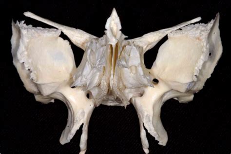 Ventral View Of Sphenoid And Ethmoid Bones Neuroanatomy The