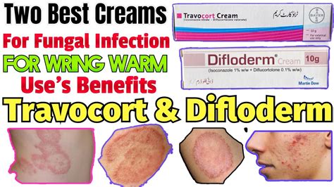 Two Best Cream For Fungal Infection Travocort Diflodem Uses