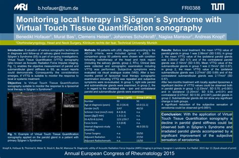 Pdf Fri0388 Monitoring Local Therapy In Sjögren S Syndrome With Virtual Touch Tissue