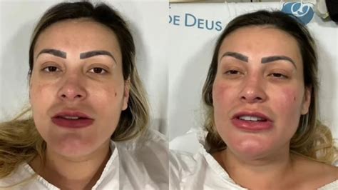 Gr Vida De Meses Andressa Urach Foi Internada S Pressas Cama Ari