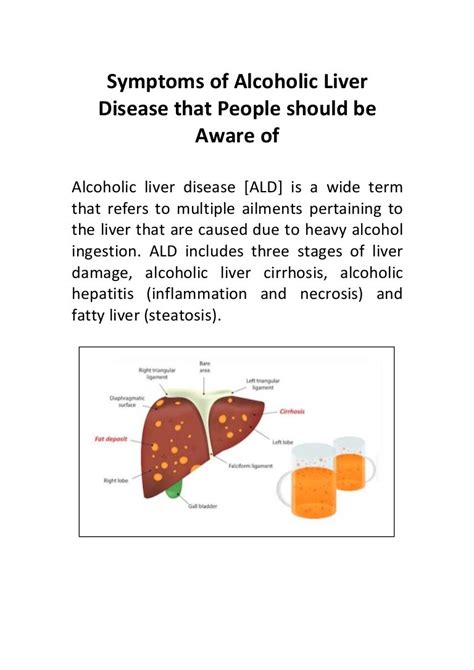 Symptoms of Alcoholic Liver Disease that People should be Aware of