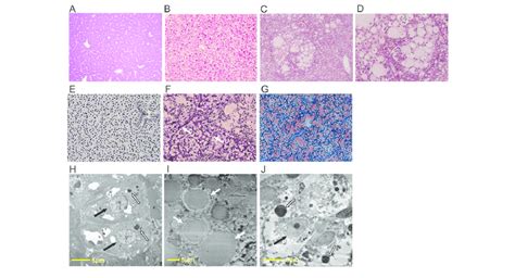 Altered Histopathology In Medaka With Hfd Induced Steatohepatitis