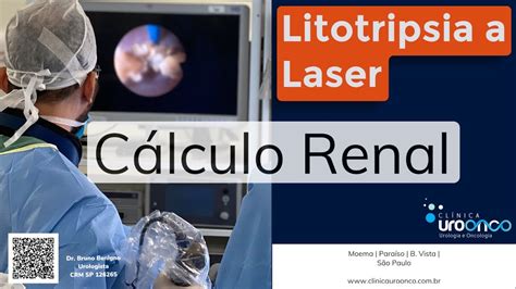 Por Que Fazer Litotripsia A Laser Para O Tratamento Do C Lculo Renal